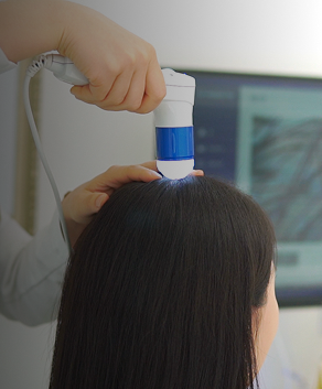 두피 정밀 진단