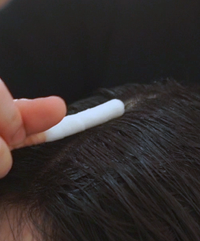 두피 스케일링 관리