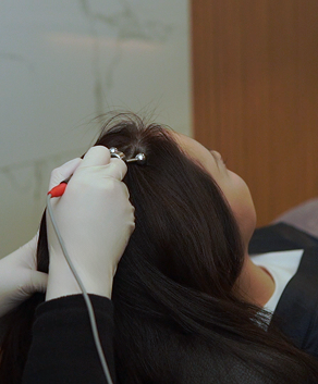 퍼스널 탈모관리